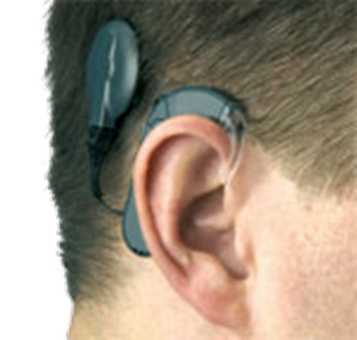 MED-EL电子耳系统