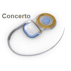 CONCERTO植入体